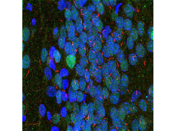 Immunofluorescence with Anti-Adenylate Cyclase III